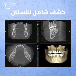 https://darelhakem.com/wp-content/uploads/2021/11/119970467_933307810513130_6445568007964452184_n-320x320.jpg